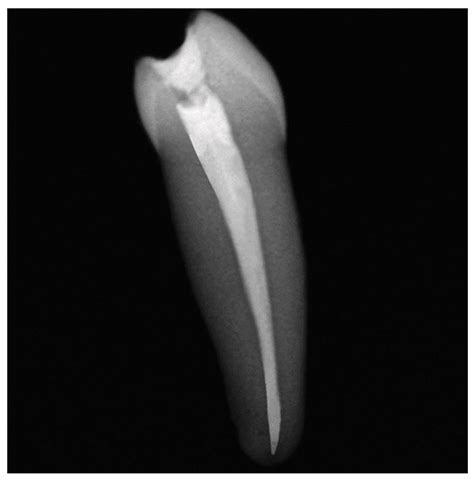 Influence of Thermal and Mechanical Load Cycling on Fracture Resistance ...