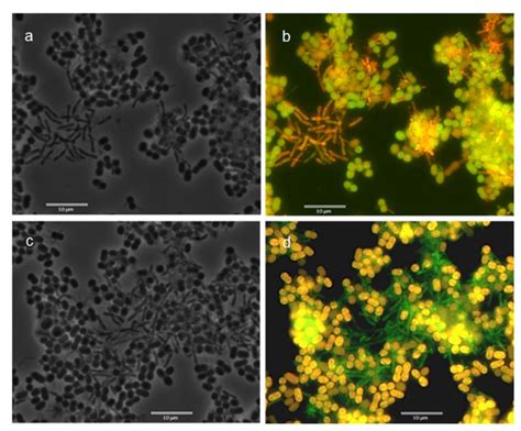 Dynamics of Microbial Communities in Phototrophic Polyhydroxyalkanoate ...