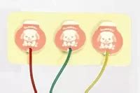 Disposable ECG Electrodes