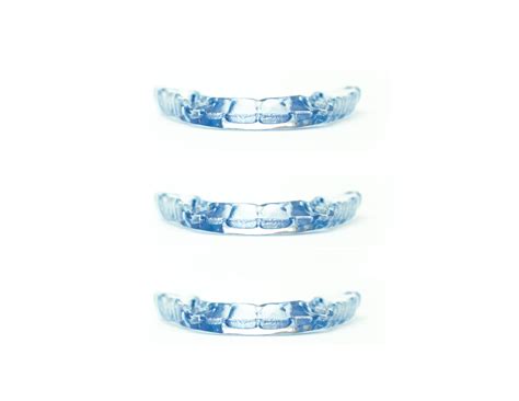 Image result for Inlab Splint Design