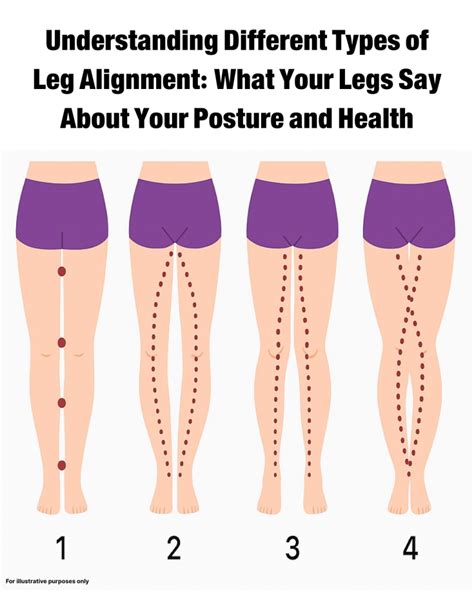 Image result for Leg Alignment