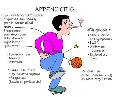 Image result for Appendicitis