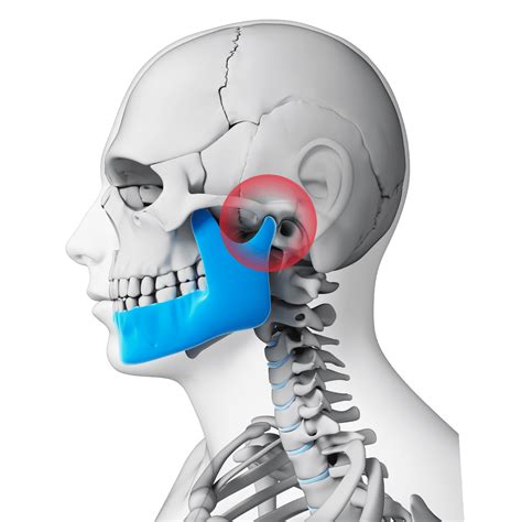 What is TMJ? What causes it and the Treatments