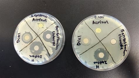 How To Measure Zone Of Inhibition In Mm at Michelle Owen blog