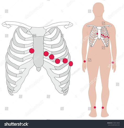Electrocardiography Ecg Ekg Electrode Placement Body Stock-illustration 745512835