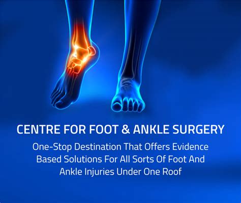 Foot & Ankle Surgery and Care in Kochi, Kerala | Aster Medcity
