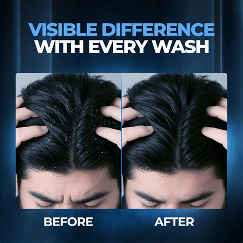 Beardo Dandruff Control Shampoo |Anti Dandruff Shampoo – Beardo India