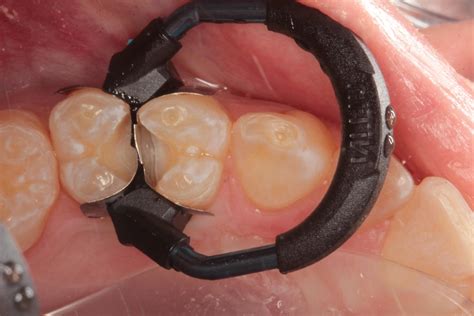 Image result for Sectional Matrix