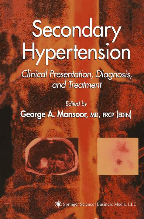 Buy Secondary Hypertension: Clinical Presentation, Diagnosis, and ...