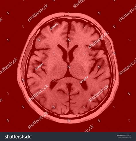High Res Brain Scan Image 的图像结果