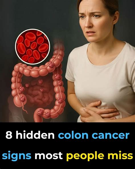 Common Signs Of Bowel Cancer You Should Never Ignore