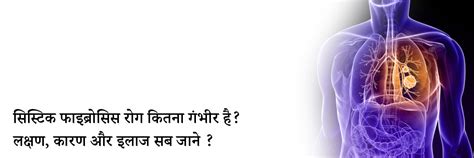 सिस्टिक फाइब्रोसिस के लक्षण, कारण, इलाज, दवा, उपचार और परहेज | Cystic ...