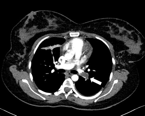 Making decisions about radiological imaging in pregnancy | The BMJ
