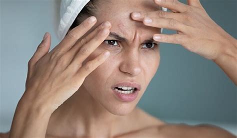 Everything you need to know about pustules