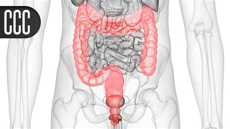 Simpler Tool Validated for Endoscopic Assessment in Crohn's | MedPage Today