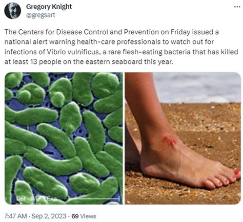 What Is A Common Flesh Eating Bacteria at Bonnie Perez blog