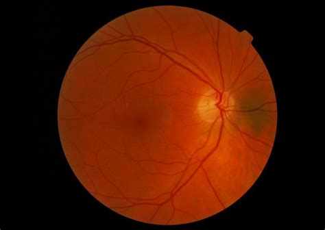 Sunanda Eye Hospital