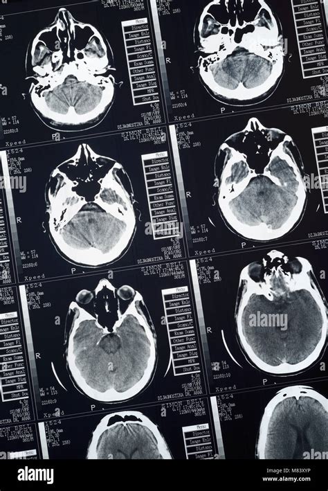 Image result for Human Brain Scan