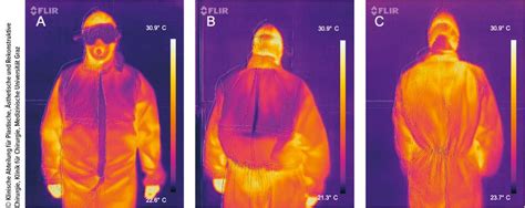 Kühlende Kleidung für vielseitige Anwendungsbereiche - Dermatologie ...