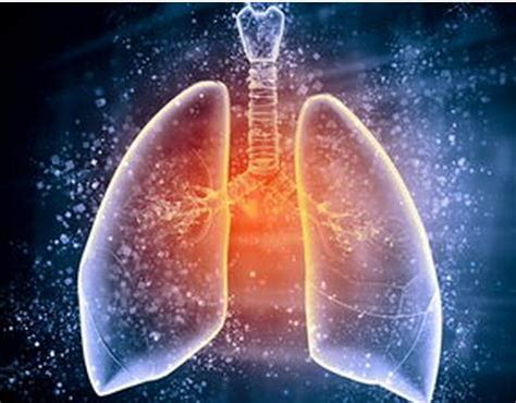 肺部钙化小结节 “不拘小节”要不得 肺部小结节的应对_第二人生