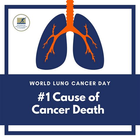 Osteopathic Physicians & Surgeons of California on LinkedIn: Today, on Lung Cancer Awareness Day ...
