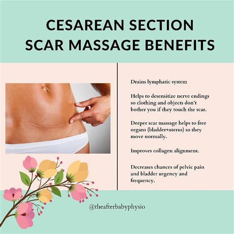 Save for later 🗣 C-section Scar Massage Benefits. NOTE: there is a safe ...