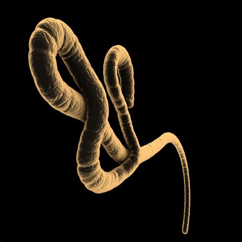 17病患逃亡 伊波拉病毒恐扩散 - 两岸要闻 - 中国时报