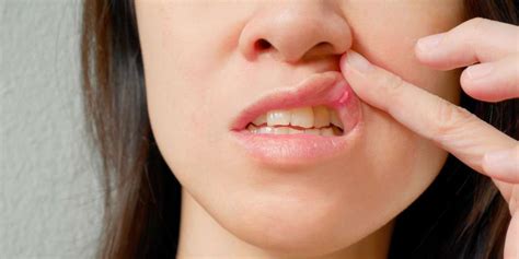 நீரிழிவு நோயின் 8 வாய்வழி அறிகுறிகள்