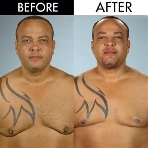 Man Boobs & Butt Implants?! See the Botched Before and Afters! - E! Online
