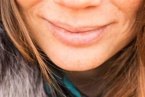 If your lips are cracking or getting cut from the corners, then ...