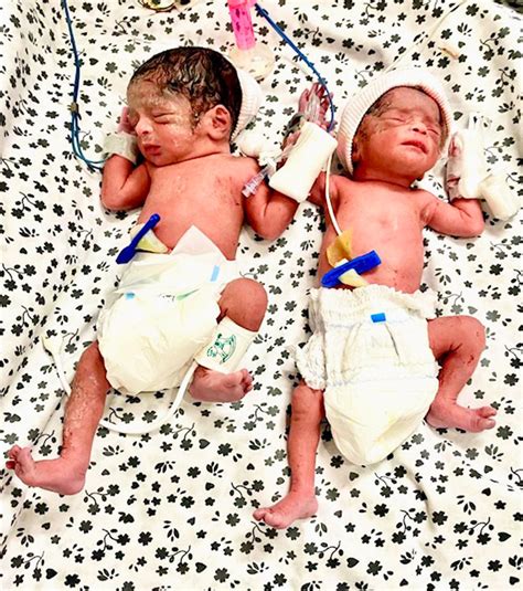 Photo Gallery | Best Fertility Centres in Hyderabad