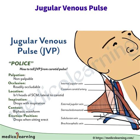 Carotid Vs Jugular Pulse