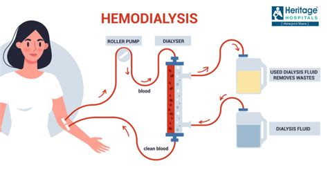 Image result for Dialysis Procedure Step by Step