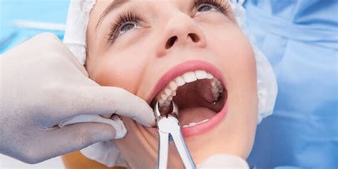 Tooth Extraction 的图像结果