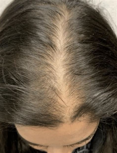 Herbal Hair Oil - Non-Greasy & Lightweight Hair Oil for Hair Growth ...