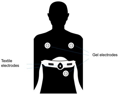 Clinical Applicability of a Textile 1-Lead ECG Device for Overnight ...