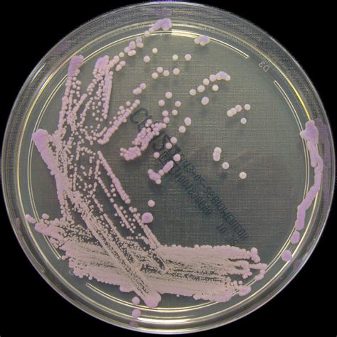 Kuvatulokset haulle candida