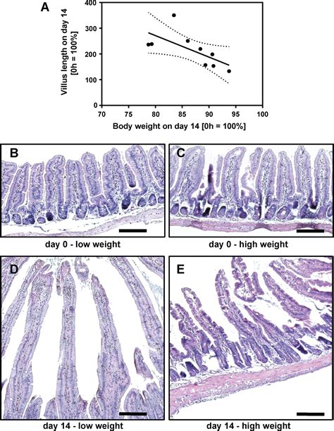 Villus Growth, Increased Intestinal Epithelial Sodium Selectivity, and Hyperaldosteronism Are ...