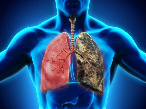 Watch This Video to Uncover the Hidden Dangers of Lung Disease and How ...