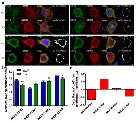 STIM Protein-NMDA2 Receptor Interaction Decreases NMDA-Dependent ...