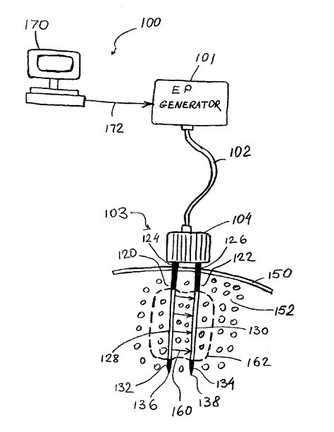 Skin piercing electrodes patented technology retrieval search results - Eureka | Patsnap