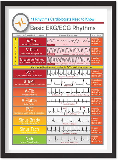 Basic EKG Class 的图像结果