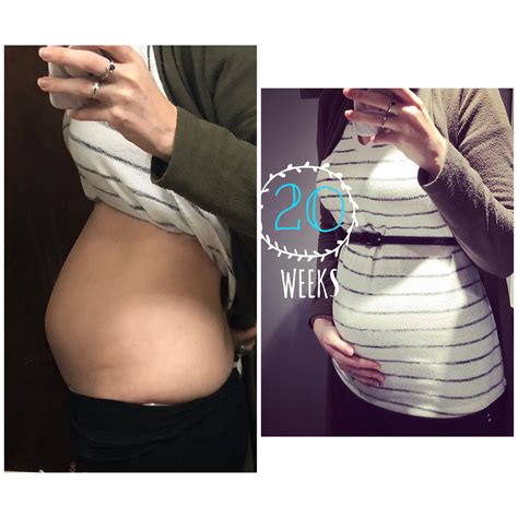 Pregnant With 20 Babies