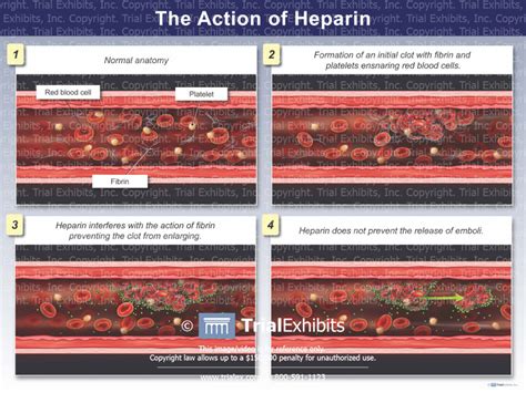 Image result for Heparin Problems