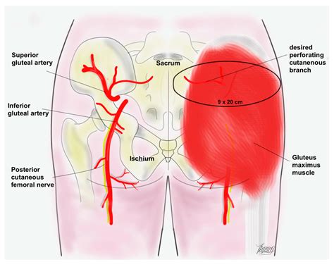 Superior Gluteal Artery