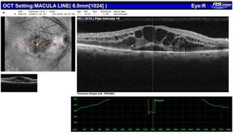Department of Ophthalmology - Chettinad Academy