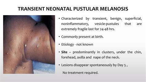 Pediatric Skin Diseases by Dr. Ramkesh Meena | PPTX