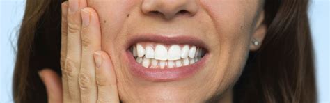 What Is gingivitis and what causes it | Pepsodent