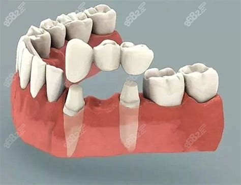 悅庭牙醫診所－台北牙醫推薦｜全瓷冠、瓷牙貼片、導引式植牙／人工植牙、舒眠無痛治療