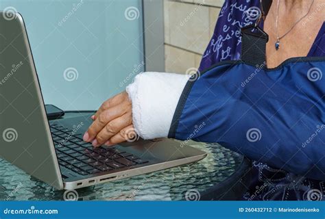 What Does A Broken Arm Feel Like at Rita Eustice blog